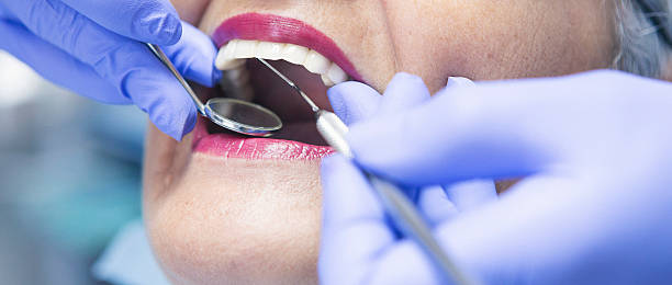 Teeth Whitening in MO